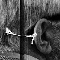 The Surreal World - A Lacuna Project